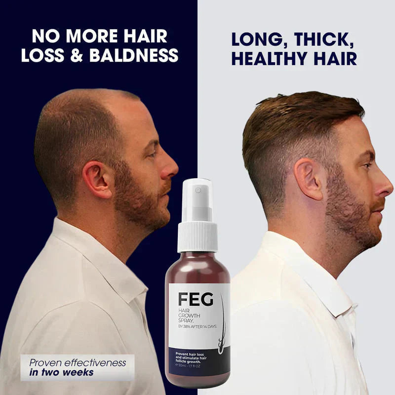 FEGPlus⢠Official 100% Natural Hair Growth Spray - (Buy 1 Get 2 Freeš„)