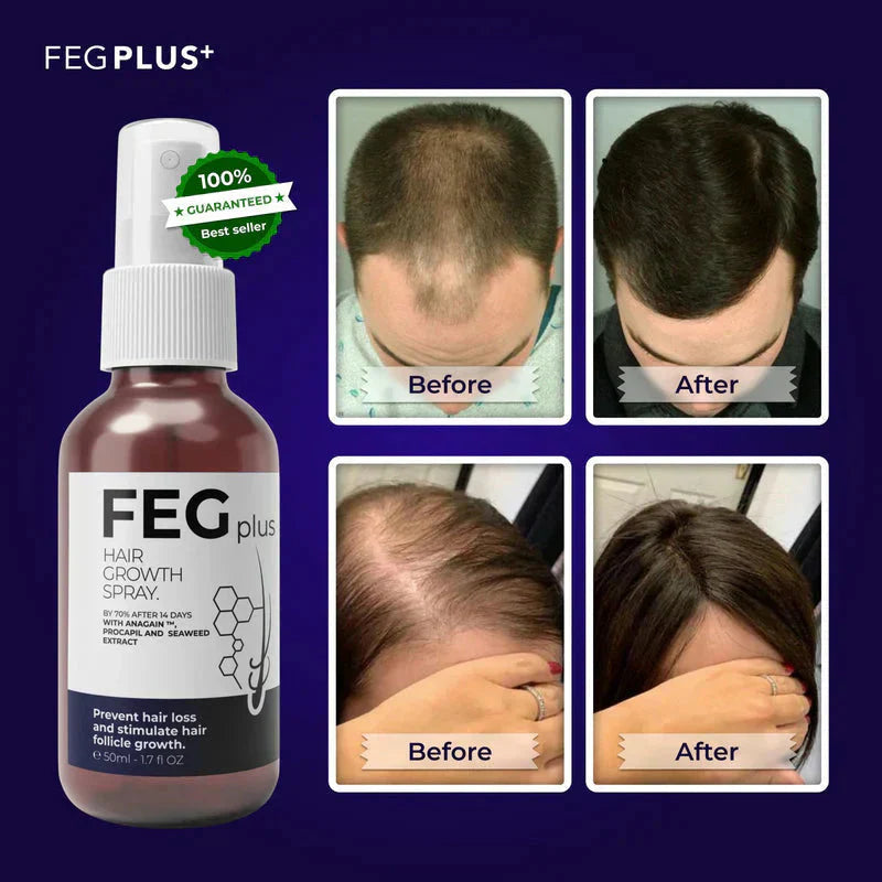FEGPlus⢠Official 100% Natural Hair Growth Spray - (Buy 1 Get 2 Freeš„)